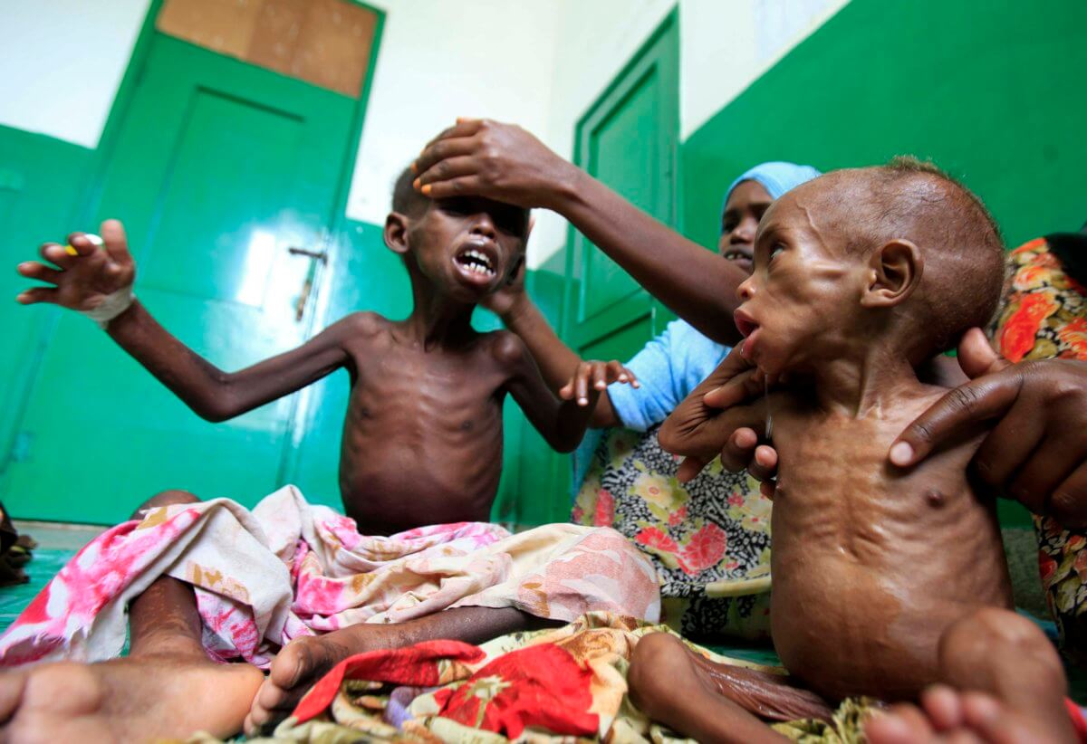 Έρευνα σοκ: Η πείνα ευθύνεται για τους μισούς θανάτους παιδιών στην Αφρική