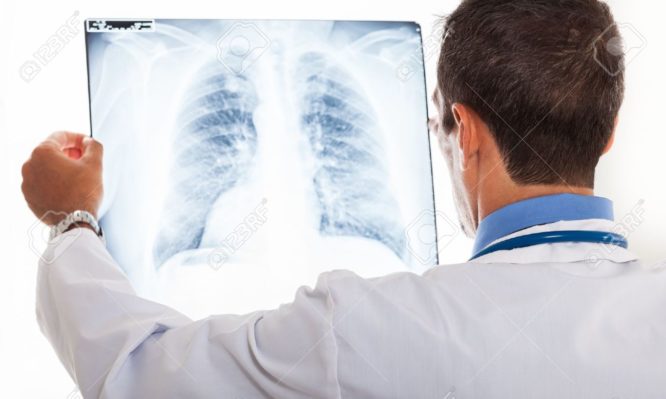 “Μυστηριώδης” πνευμονοπάθεια: Ποια συμπτώματα πρέπει να σας ανησυχήσουν αν είστε ατμιστής