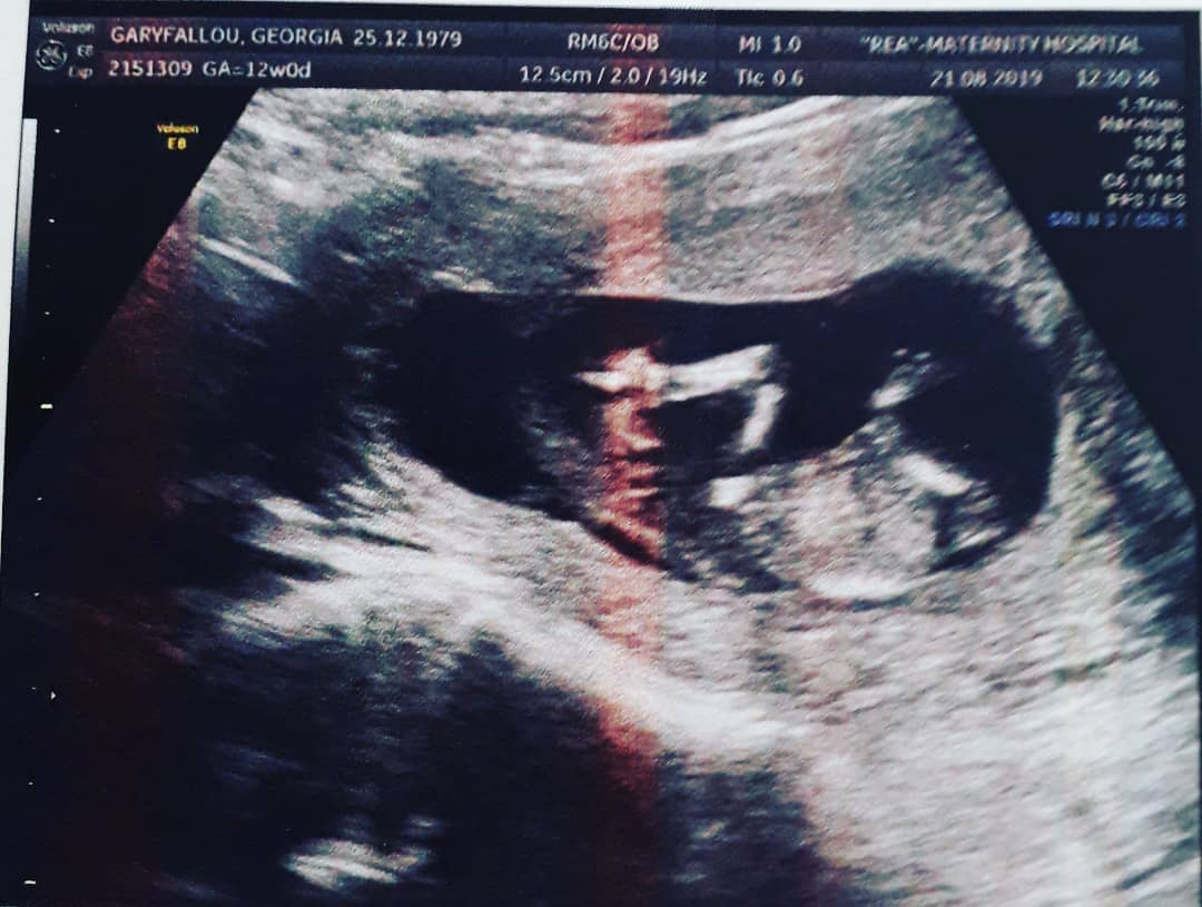 Γνωστή Ελληνίδα ανακοίνωσε στο Instagram ότι είναι έγκυος!