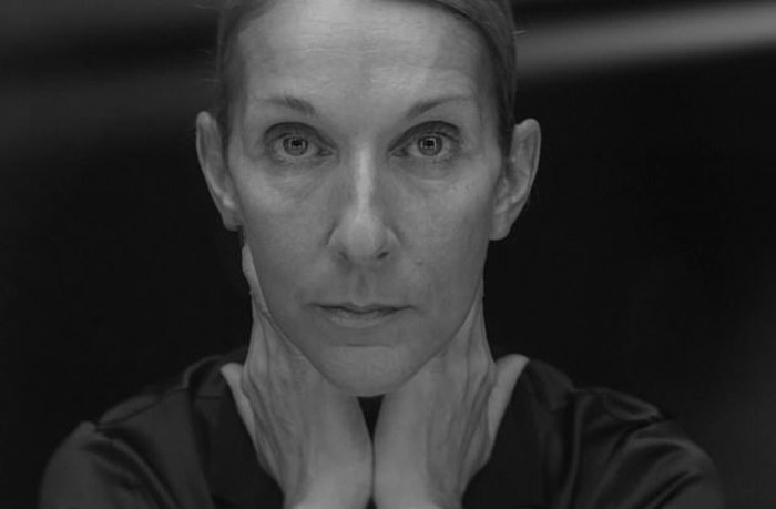 Η Celine Dion, απαντά σε όσους την “κράζουν” για την αποστεωμένη εικόνα της! Βίντεο