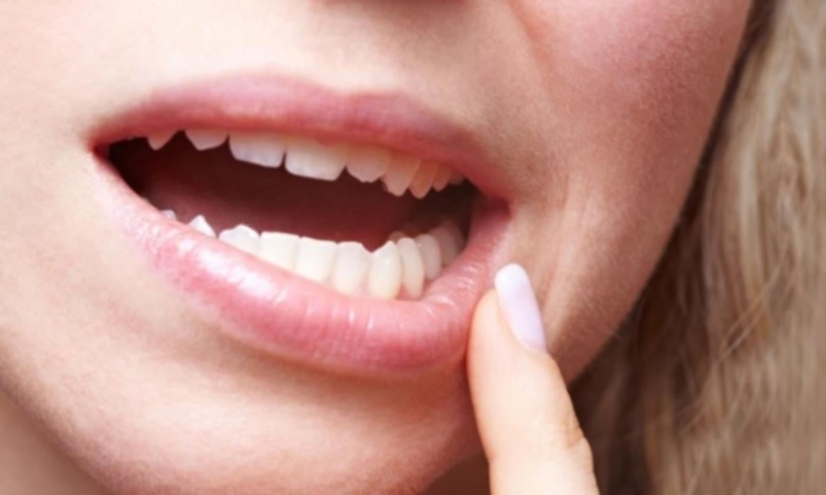 Κορονοϊός: Προκαλεί και απώλεια δοντιών; Τι δείχνουν νέα στοιχεία