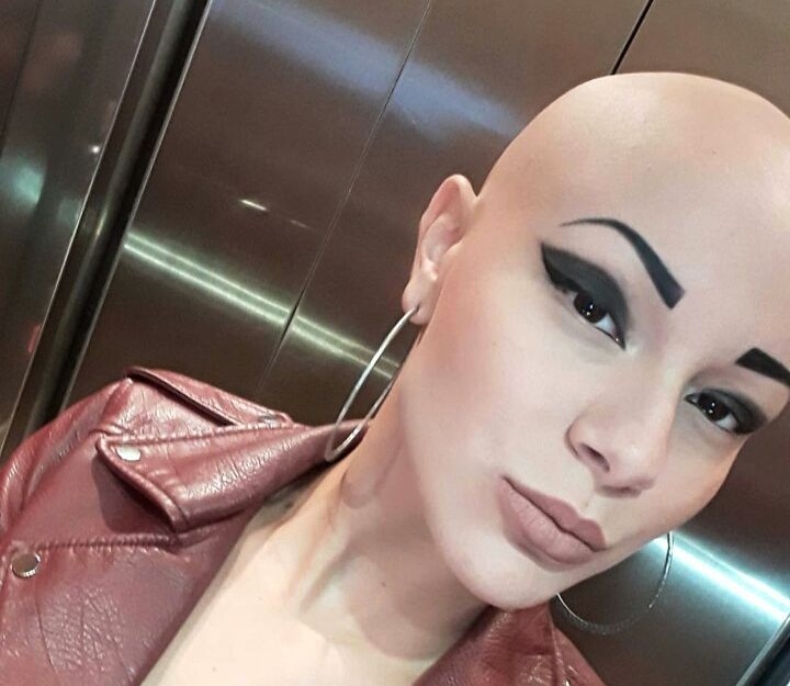 GNTM: 11 φωτογραφίες της Λυδίας με την αλωπεκία που ενθουσίασε του κριτές!