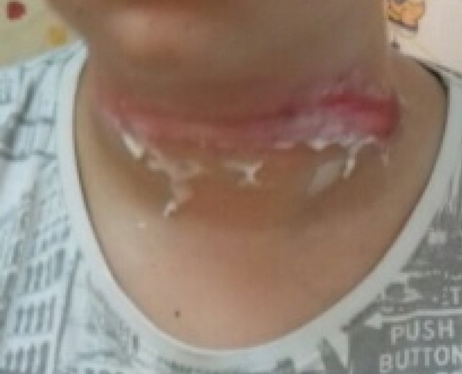 Ηράκλειο: Το σχοινί της παρέλασης παραλίγο να σκοτώσει 13χρονο παιδί – Το ξέσπασμα του πατέρα του [pics]