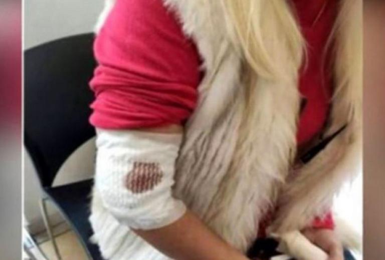 Λαμία: Εφιάλτης για γυναίκα στα δόντια αδέσποτου σκύλου - Η άγρια επίθεση - video