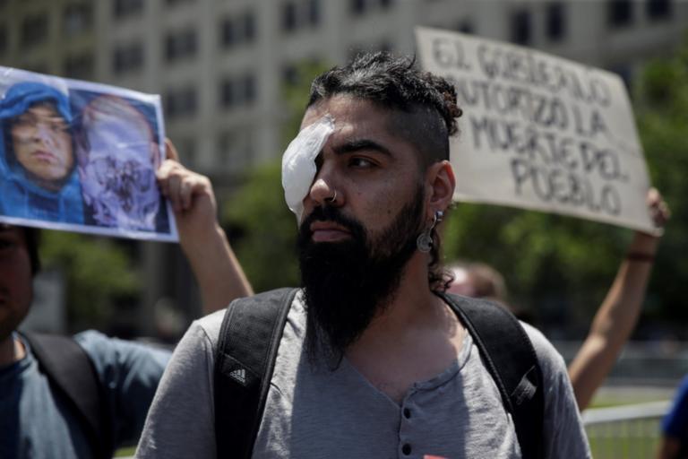 Εκατοντάδες Χιλιανοί τυφλώθηκαν από τις επιθέσεις αστυνομικών στις διαδηλώσεις [Pics]