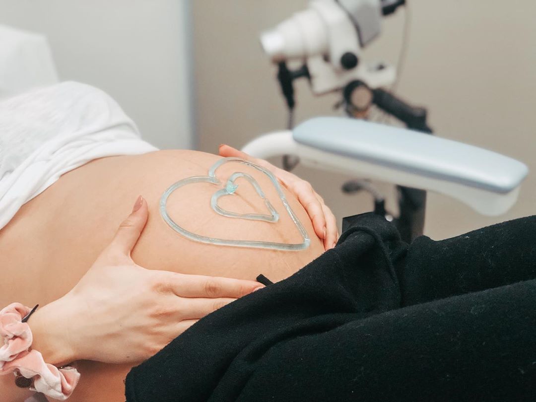 Η γνωστή Ελληνίδα έκανε υπερηχογράφημα και μας έδειξε τη φουσκωμένη κοιλίτσα της!