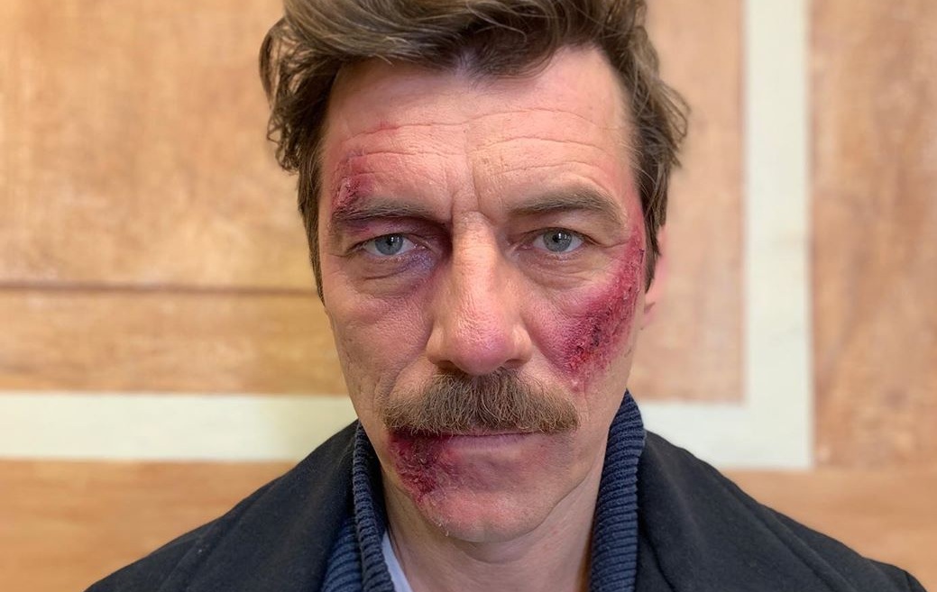 Άγριες Μέλισσες: Έφαγε πολύ ξύλο ο Θωμάς Κυπραίος, Γιάννης Στάνκογλου!