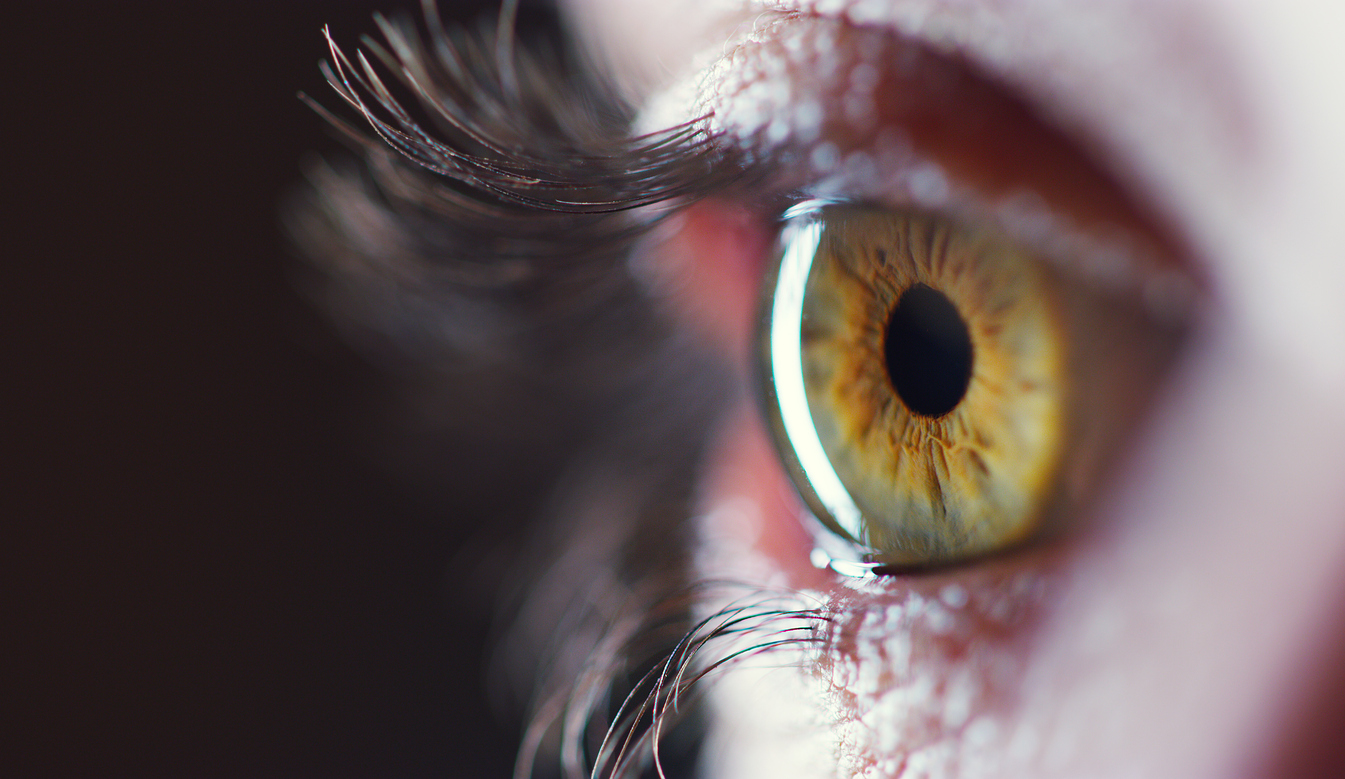 Δείτε πώς γίνεται το μάτι αν “ξεφλουδίσει” η ίριδα! Απίστευτη σπάνια φωτό από ιατρική υπόθεση