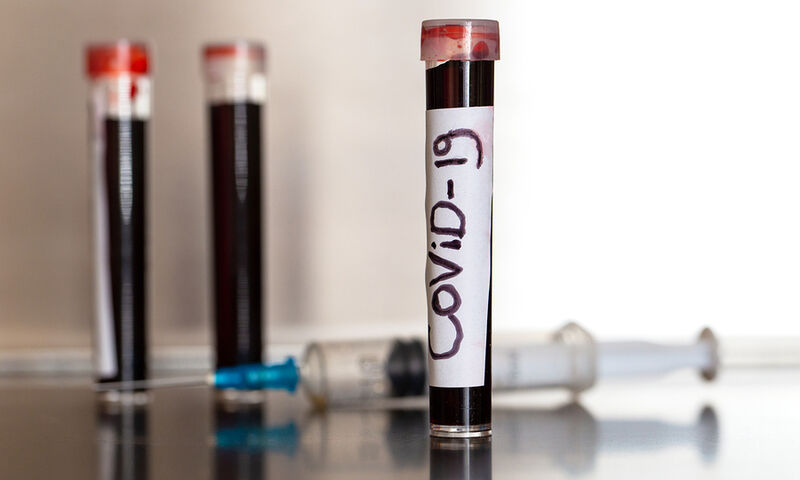 Έλληνας τραγουδιστής ξαναέκανε το τεστ για τον κορονοϊό! Αυτά είναι τα αποτελέσματα