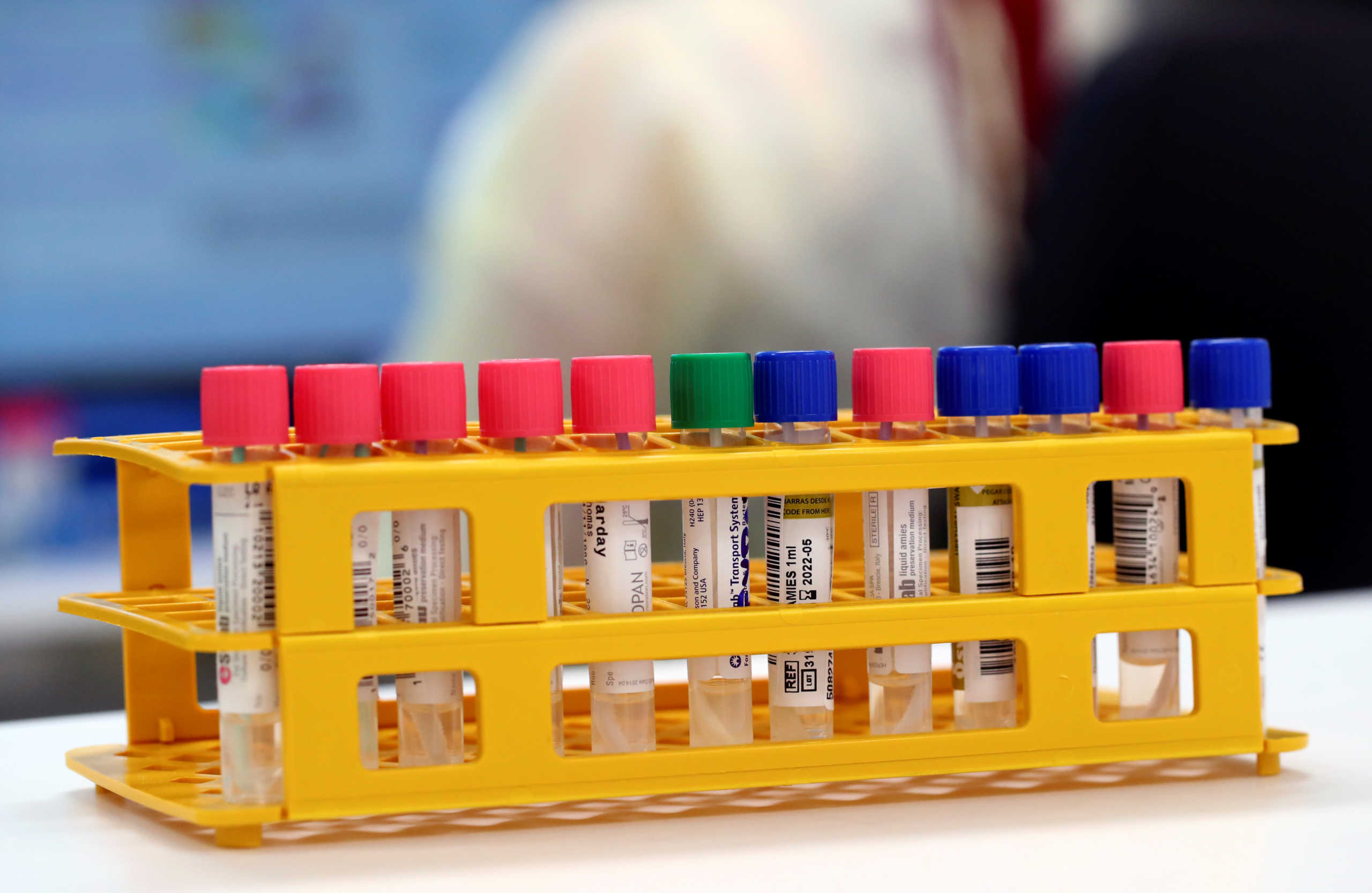 Tube tests are pictured pictured as media visit the Microbiology Laboratory of the University Hospital (CHUV) during the coronavirus disease (COVID-19) outbreak in Lausanne, Switzerland, March 23, 2020. REUTERS