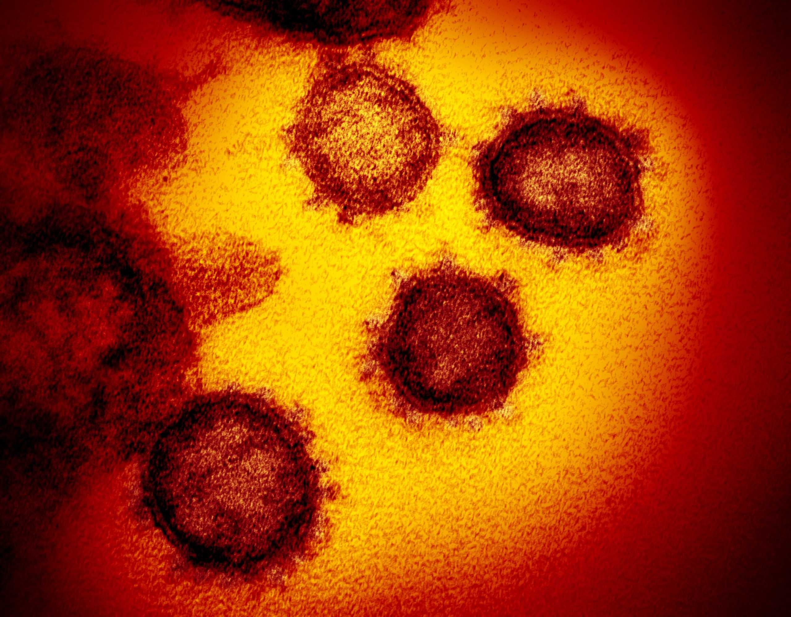 An undated transmission electron microscope image shows SARS-CoV-2, also known as novel coronavirus, the virus that causes COVID-19, isolated from a patient in the U.S., emerging from the surface of cells cultured in the lab. NIAID-RML