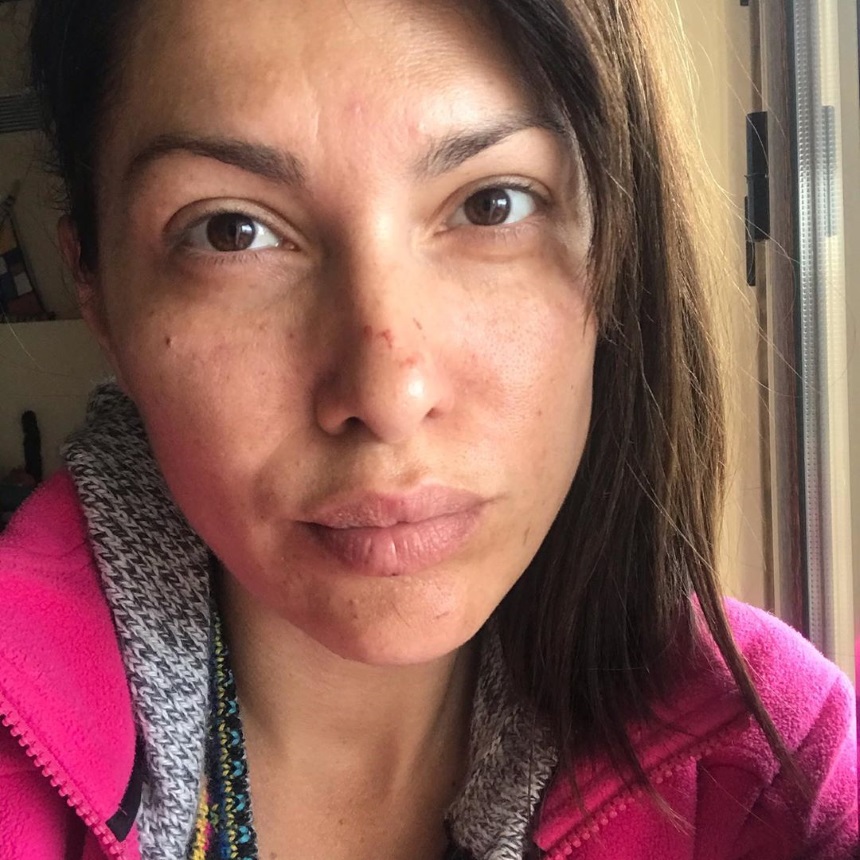 Κλέλια Ρένεση: Το πρόσωπό της γέμισε γρατζουνιές – Τι συνέβη;