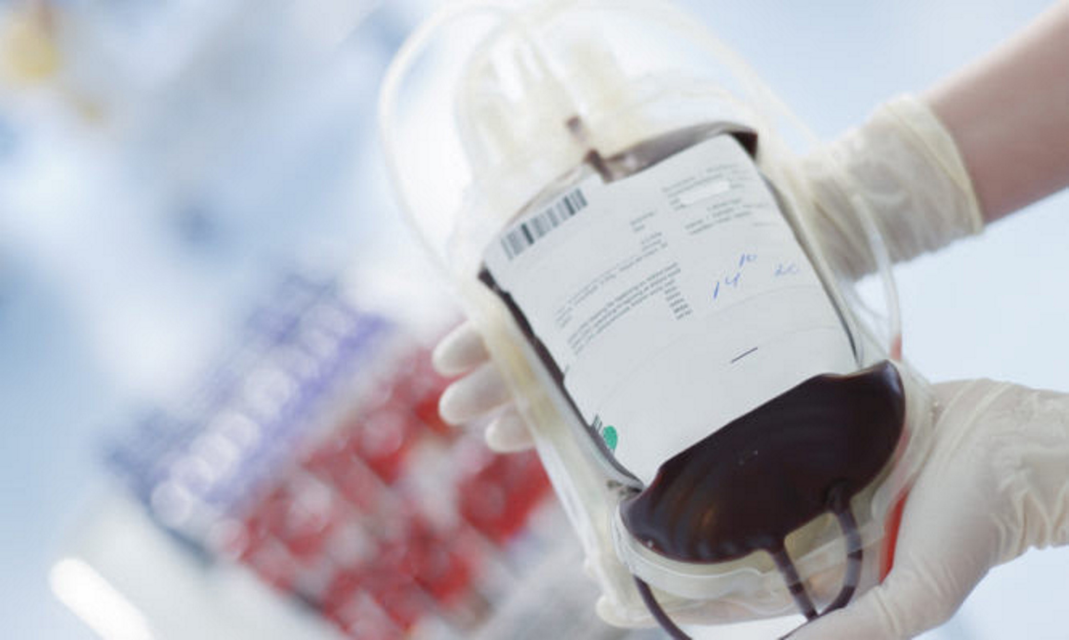 Nurse holding blood transfusion bag.