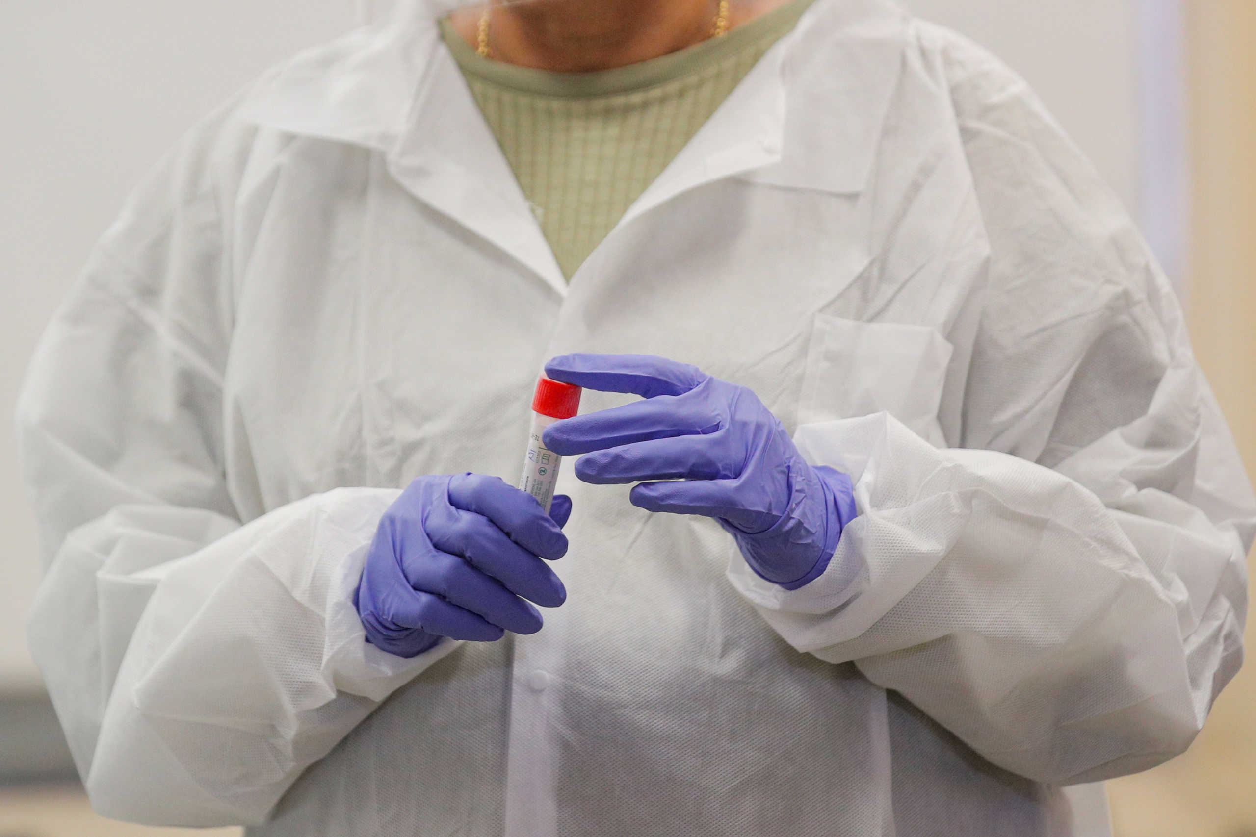ΕΑΠ: Δωρεά διαγνωστικών τεστ κορονοϊού σε πανεπιστημιακά μικροβιολογικά εργαστήρια