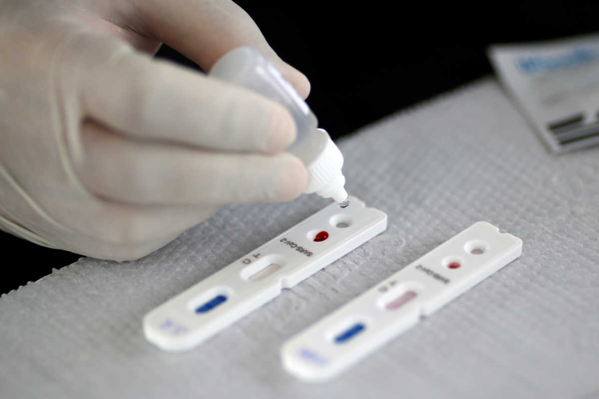 Μυτιλήνη: Μοριακός έλεγχος realtime PCR για κορονοϊό στο νοσοκομείο του νησιού