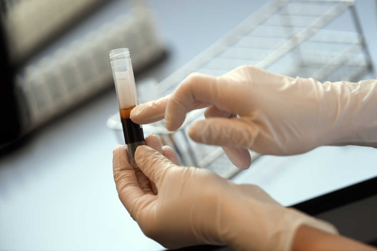 Sonja Krauthoefer of the University Hospital Erlangen checks donated blood and plasma samples, if the blood of the donor can be used for the production of therapeutic plasma for the treatment of seriously ill patients, as the spread of the coronavirus disease (COVID-19) continues in Erlangen, Germany, April 7, 2020. REUTERS
