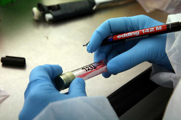 Ευλογιά των πιθήκων: Σε ετοιμότητα το Ινστιτούτο Παστέρ για τη διάγνωση κρουσμάτων στην Ελλάδα