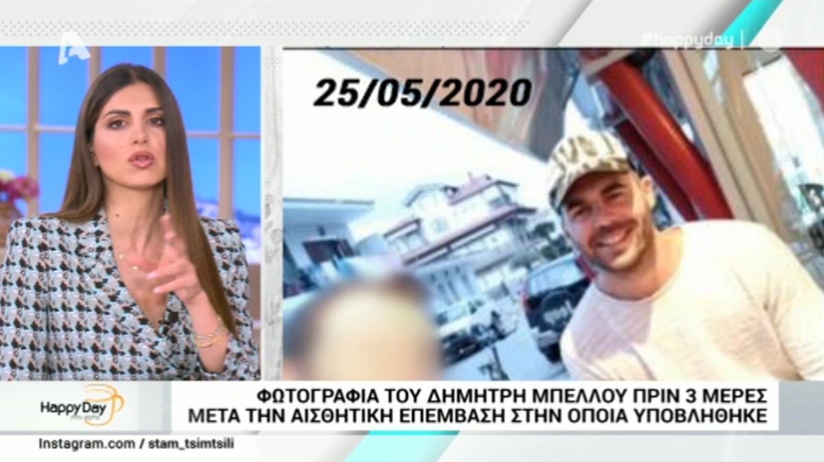 Αυτή είναι η αισθητική επέμβαση που έκανε ο Δημήτρης Μπέλλος – ΦΩΤΟ