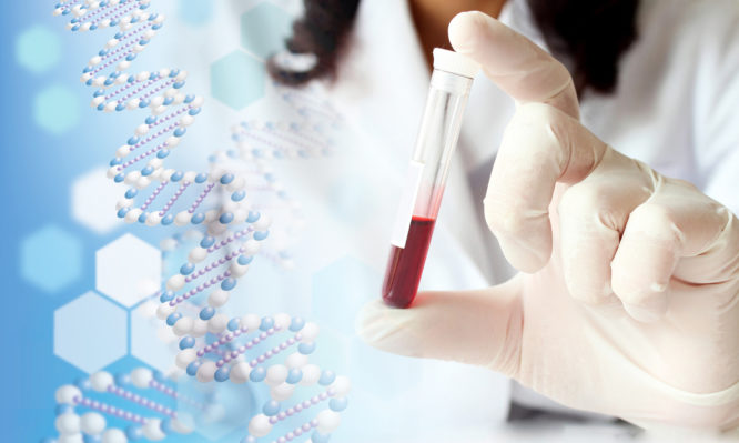 Καρκίνος του προστάτη: Εξέταση αίματος δείχνει την ανταπόκριση στη θεραπεία