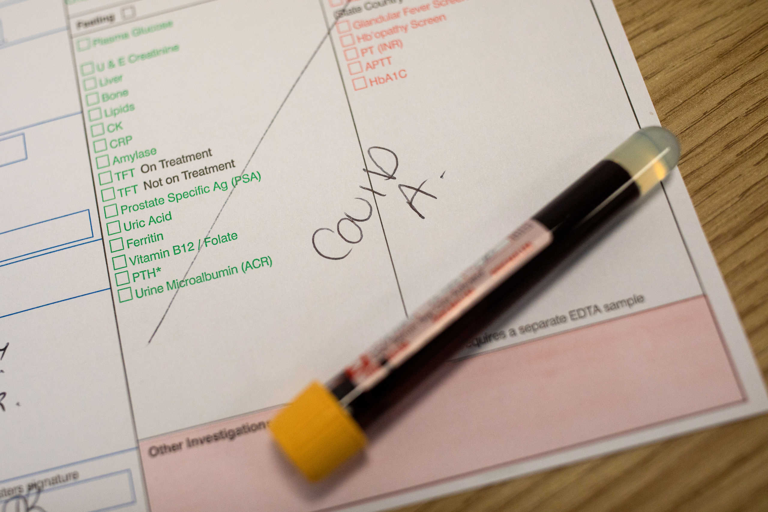 A blood sample sits on a table at an antibody testing program at the Hollymoor Ambulance Hub of the West Midlands Ambulance Service, operated by the West Midlands Ambulance Service NHS Foundation Trust, in Birmingham, Britain June 5, 2020. Simon Dawson