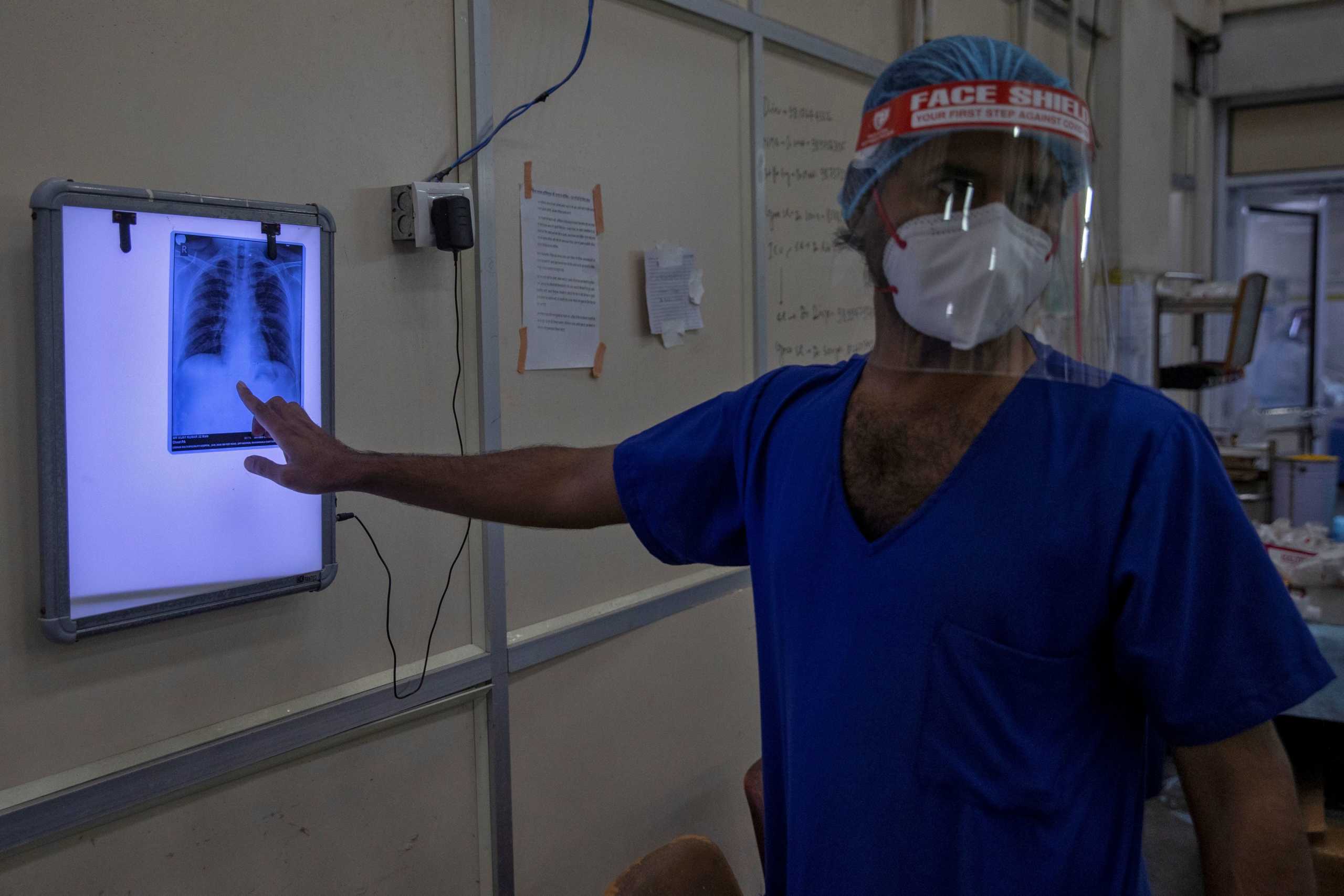 A medical worker looks at the x-ray of a patient suffering from the coronavirus disease (COVID-19) at the casualty ward in Lok Nayak Jai Prakash (LNJP) hospital, in New Delhi, India July 17, 2020. REUTERS