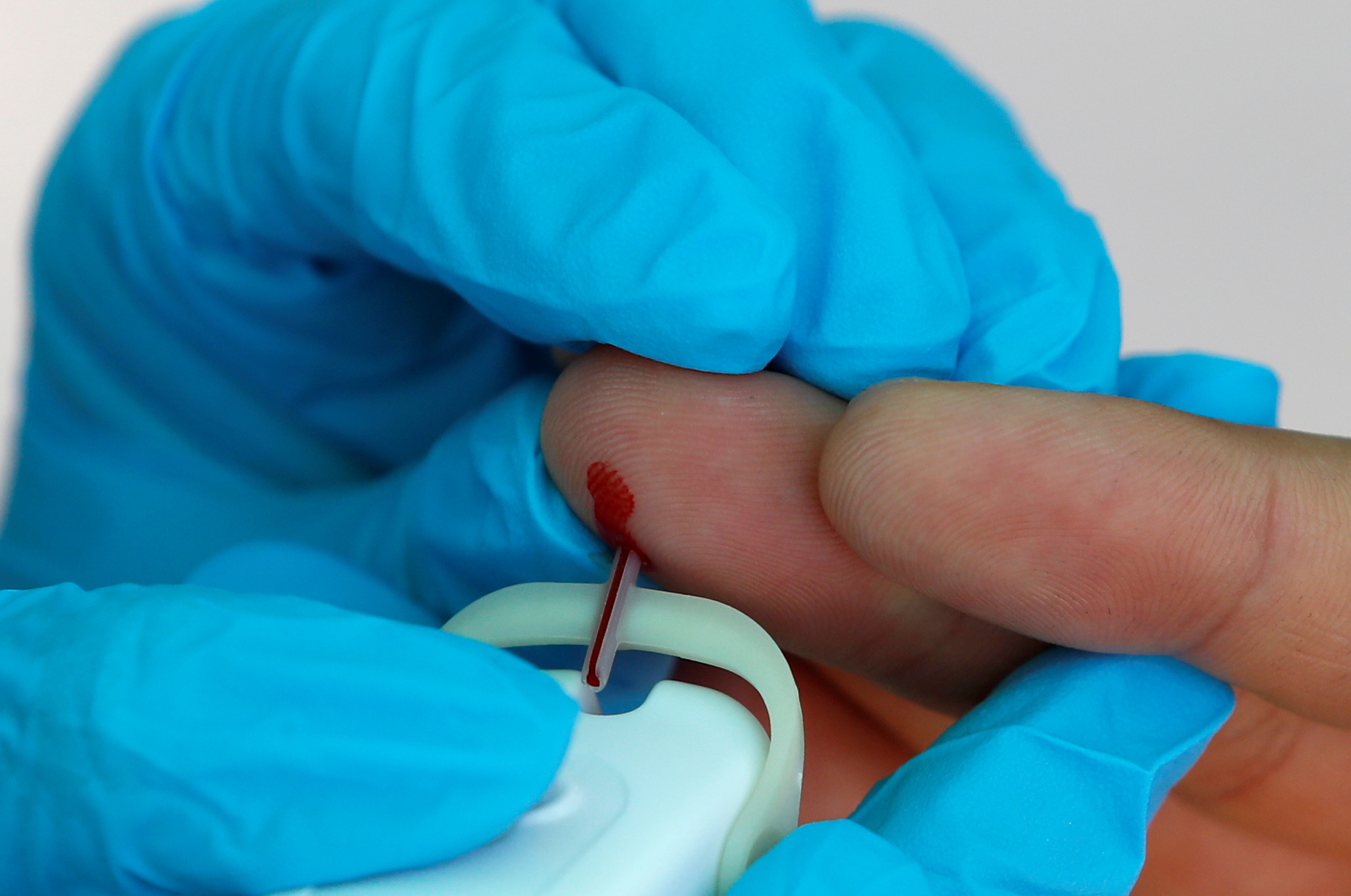 Ο κορονοϊός στο μικροσκόπιο: Οι παράξενες επιστημονικές ανακαλύψεις για το DNA του και ποιοι μύθοι διαλύονται