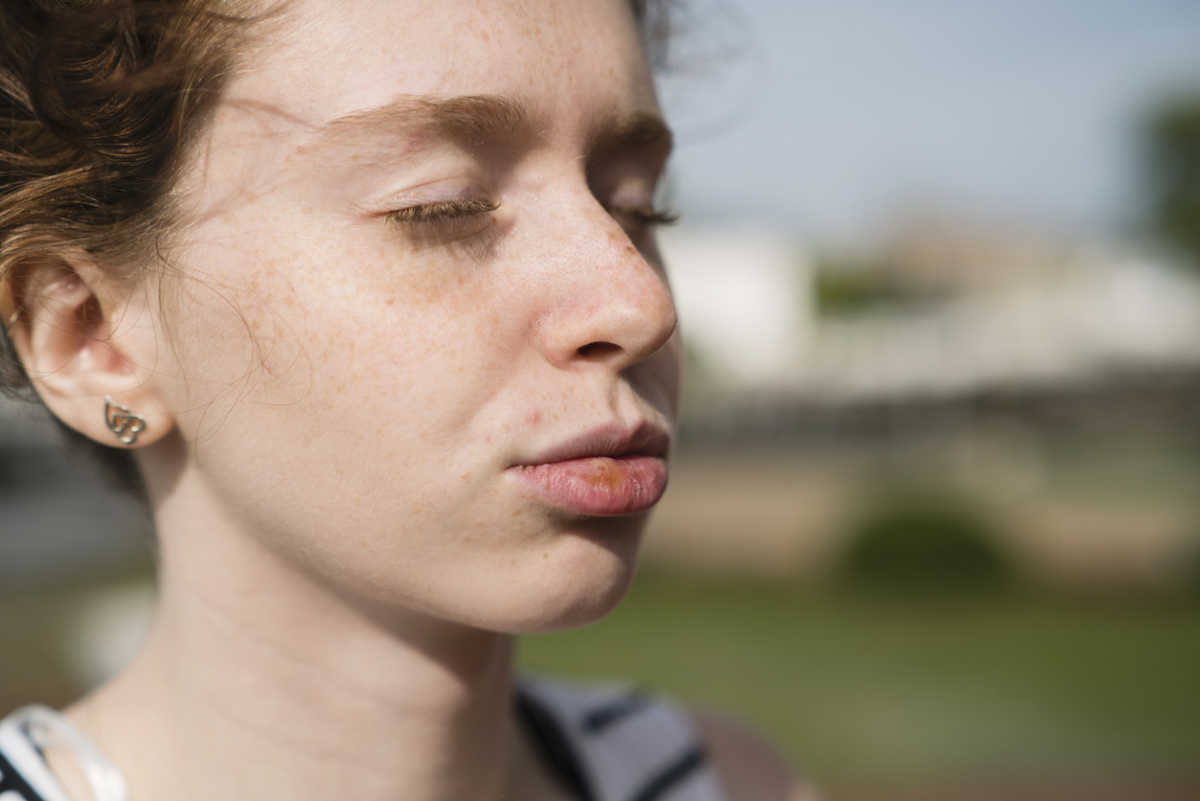 Έρπης στα χείλη: Τι συμβαίνει με τον ήλιο το καλοκαίρι – Συμπτώματα και αντιμετώπιση