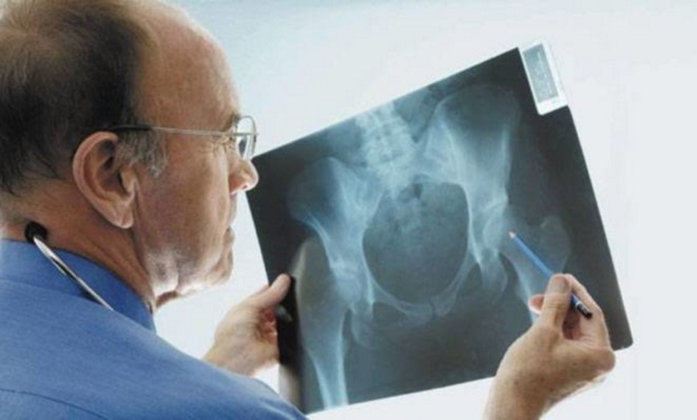 Αλτσχάιμερ: Γιατί ηλικιωμένοι ασθενείς κινδυνεύουν από κάταγμα ισχίου