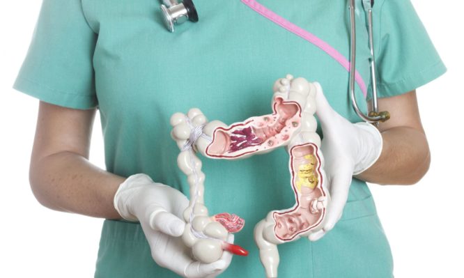 Καρκίνος του παχέος εντέρου: Πώς να τον προλάβετε!