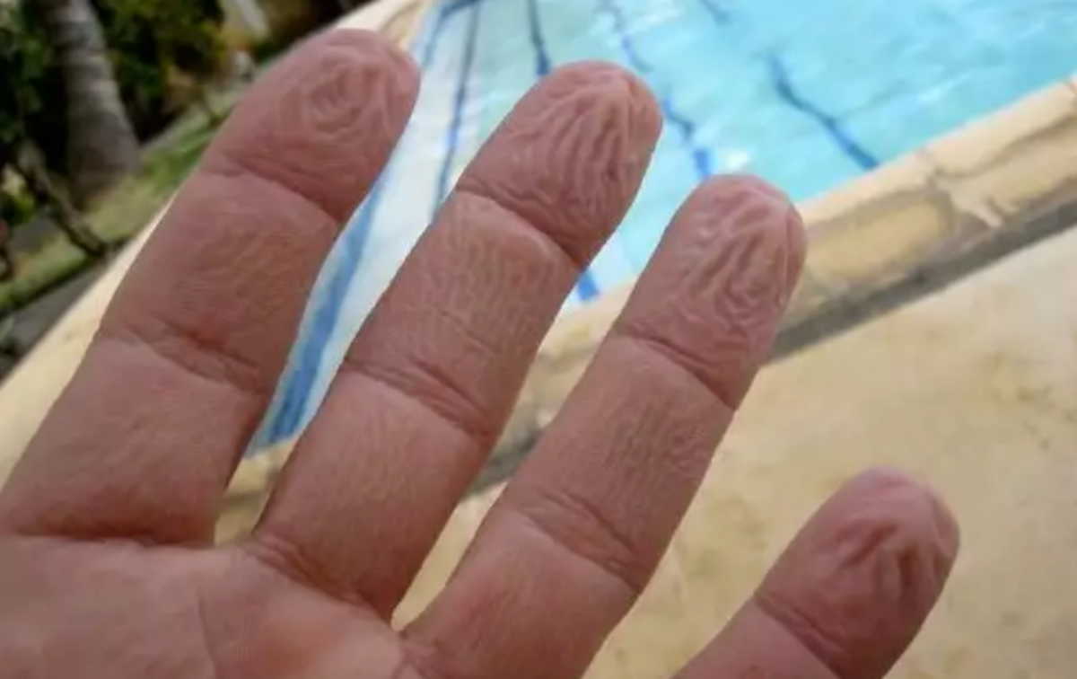 Γιατί τα δάχτυλα «ζαρώνουν» μέσα στο νερό: Δεν είναι επειδή «μούλιασαν»