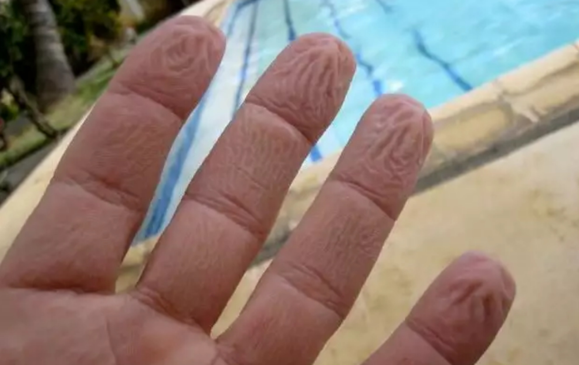 Γιατί τα δάχτυλα «ζαρώνουν» μέσα στο νερό: Δεν είναι επειδή «μούλιασαν»