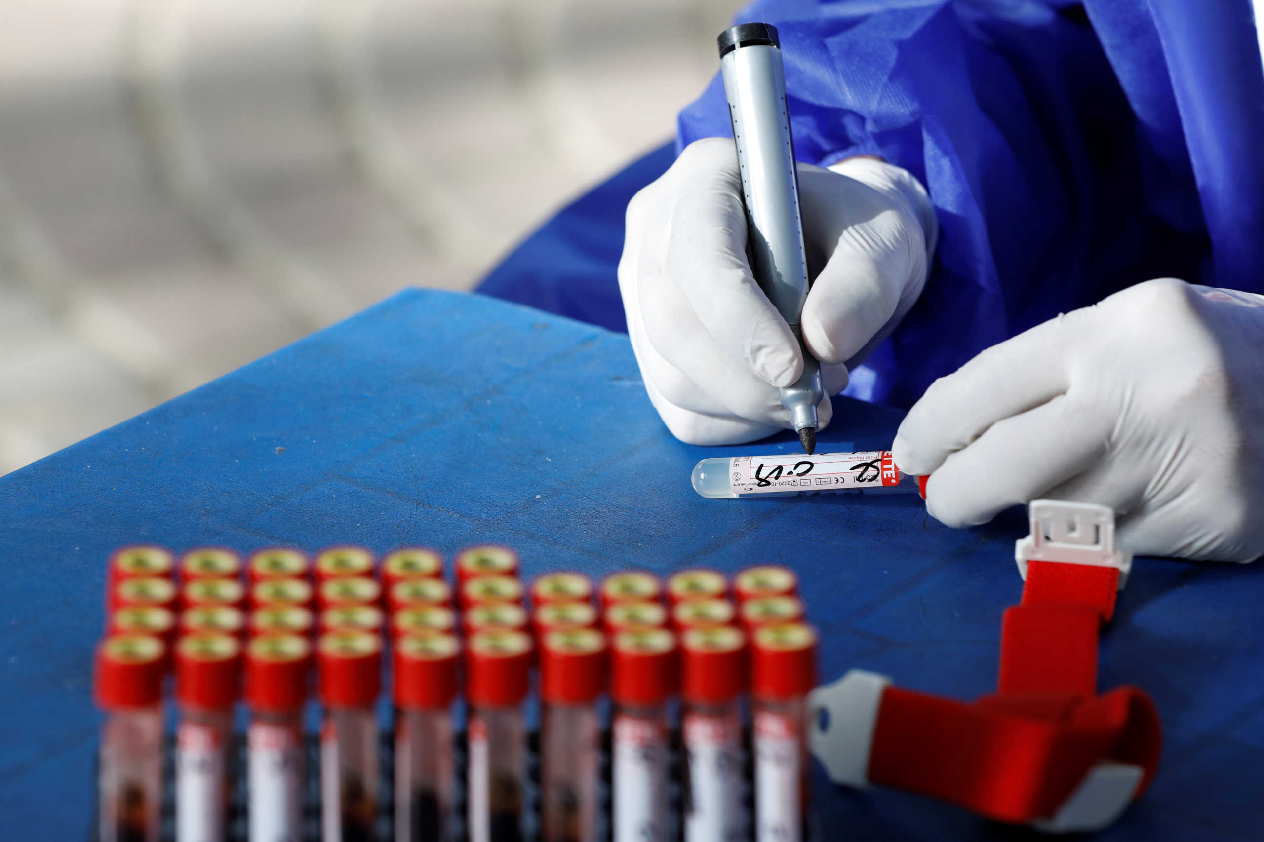 A paramedic wearing protective gloves writes a note on a test tube before taking a blood sample to be tested for the coronavirus disease (COVID-19) anti-body test, at a camp in Karachi, Pakistan July 24, 2020. REUTERS