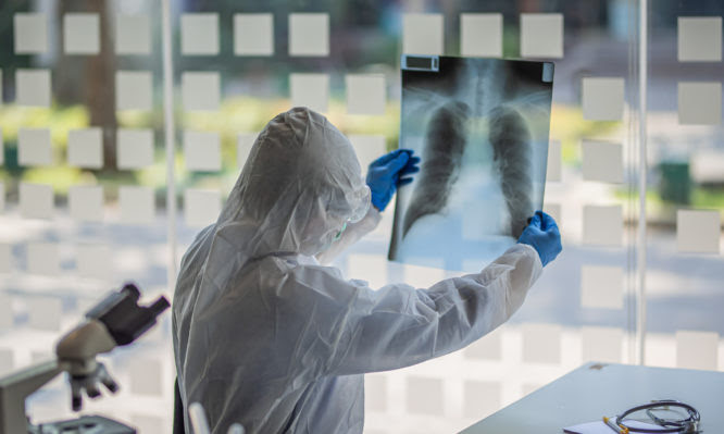 Film chest x-ray PA upright : show normal human's chest.