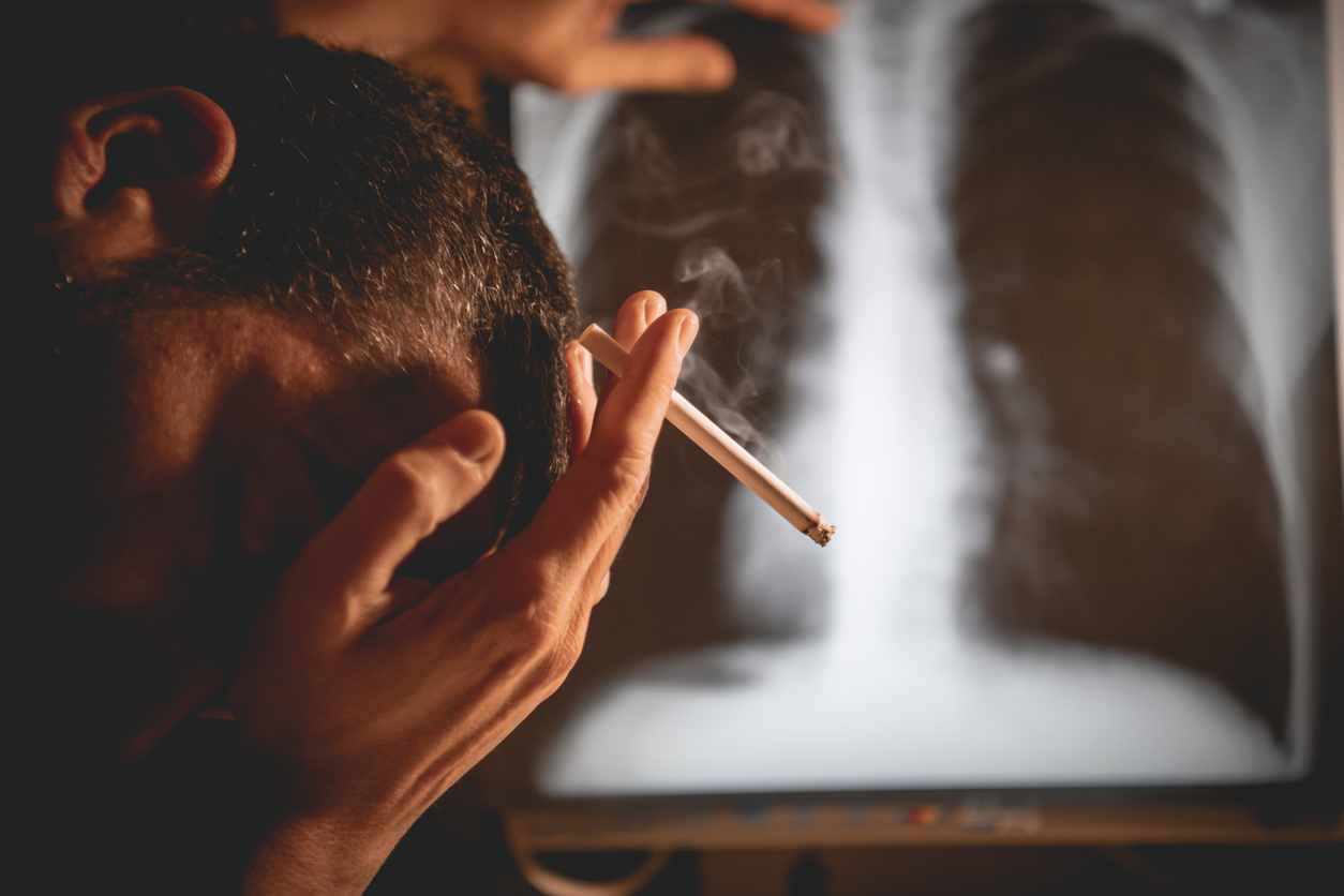 Πώς γίνονται οι πνεύμονες από το κάπνισμα και πόσο καιρό χρειάζονται για να καθαρίσουν