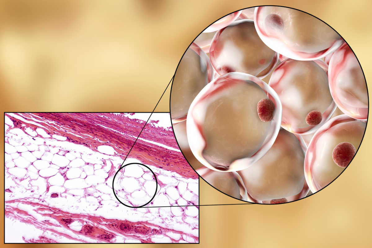 Βρήκαν τον “διακόπτη” του οργανισμού για να μετατρέπουμε με φάρμακα το λίπος σε ενέργεια