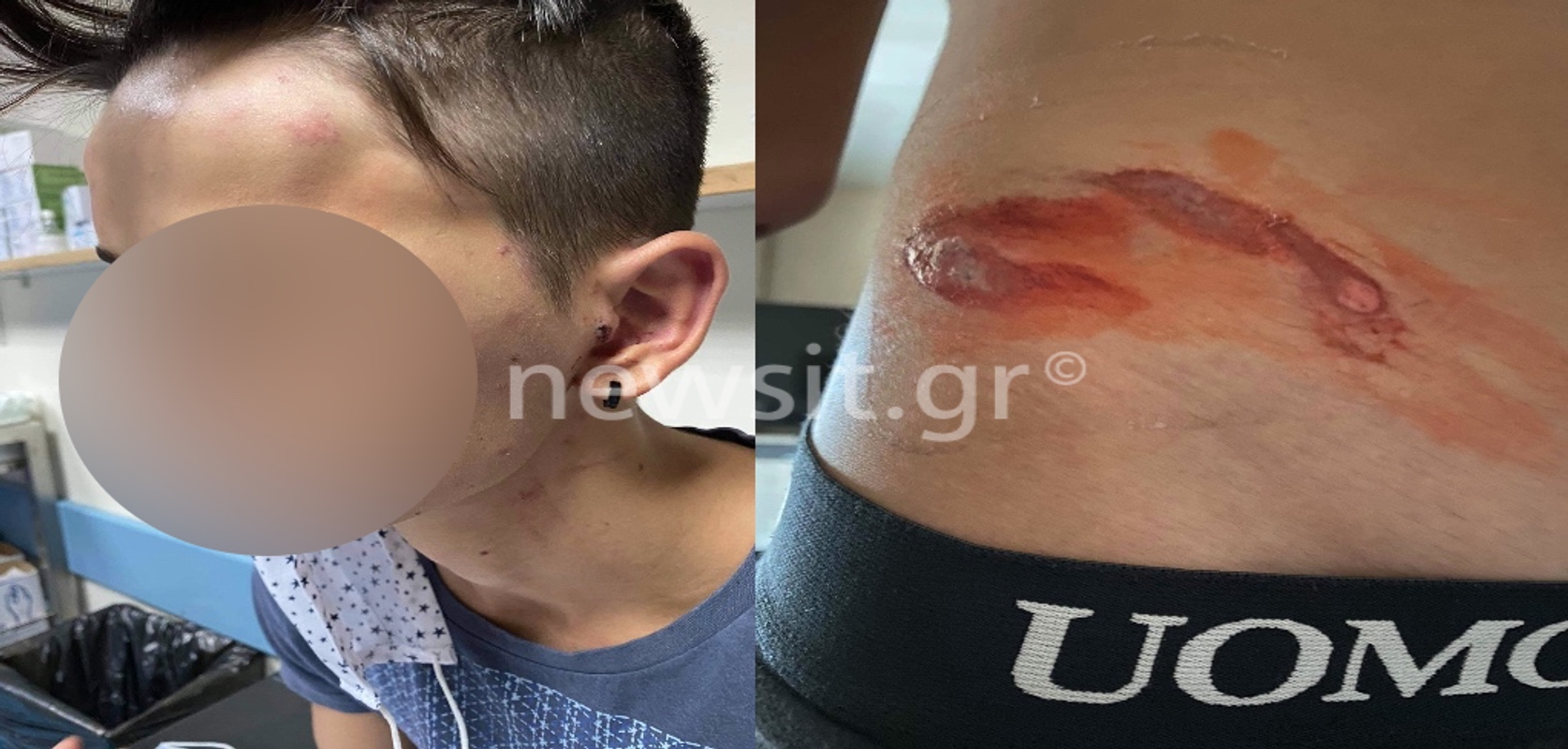 Συμμορία 20 ανηλίκων σπέρνει τον τρόμο στο Γαλάτσι – Χτυπούσαν ανελέητα 17χρονο