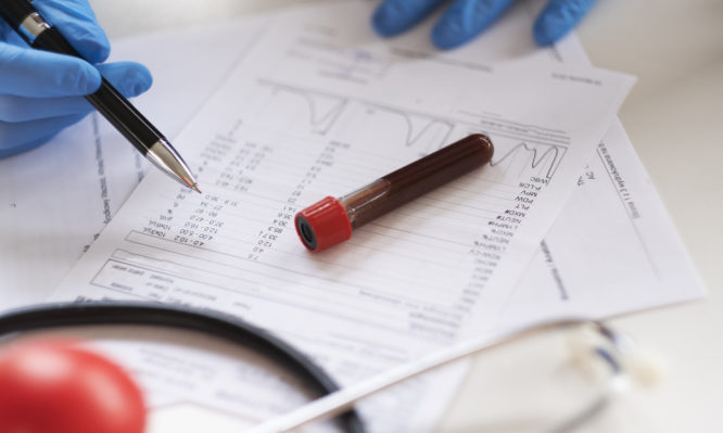 Κορονοϊός: Απλή εξέταση αίματος δείχνει πόσο σοβαρή θα είναι η λοίμωξη