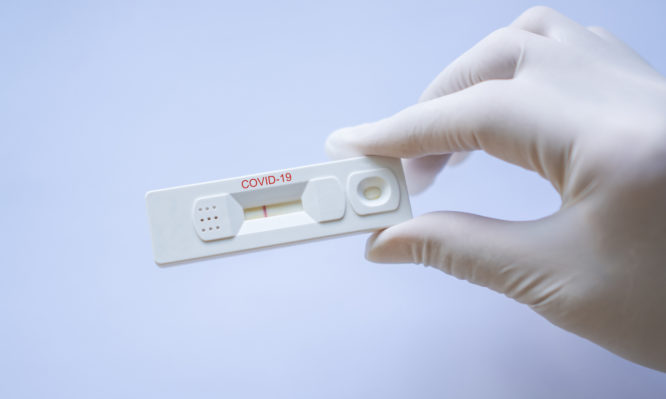 Κορονοϊός: Πόσο αποτελεσματικά (%) είναι τα τεστ αντισωμάτων στον εντοπισμό του ιού