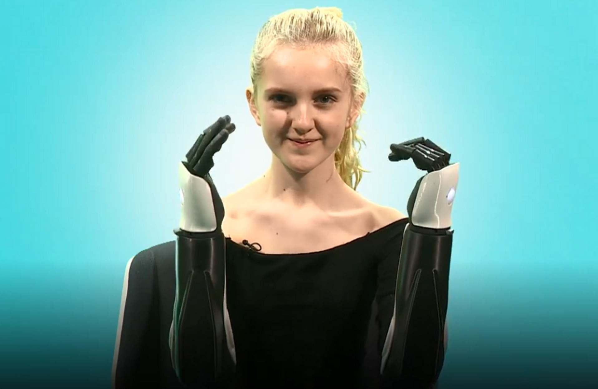 Δύναμη της θέλησης! 14χρονη με τεχνητά χέρια ξεκινά καριέρα στην τηλεόραση (pics, video)