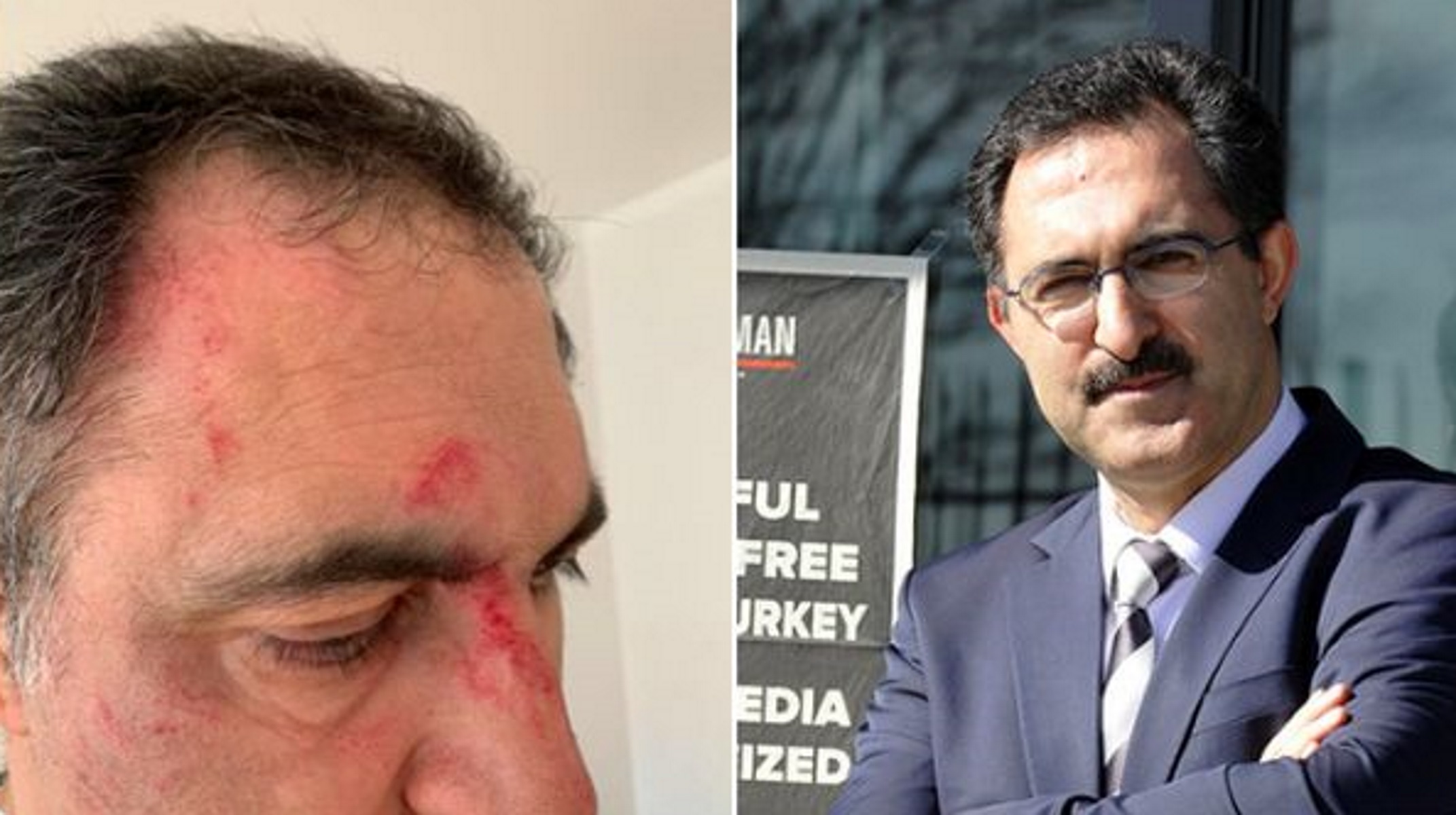Άγριος ξυλοδαρμός πασίγνωστου δημοσιογράφου – επικριτή του Ερντογάν (pic)