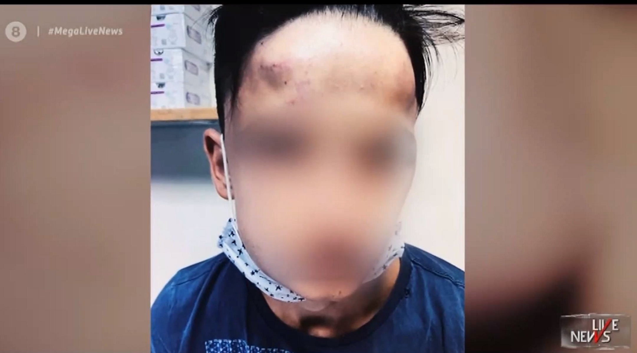 Γαλάτσι: Συγκλονίζει ο 17χρονος – «20 άτομα μου έριχναν κλωτσιές και μπουνιές στο κεφάλι»