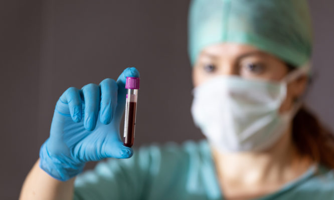 Αν έχεις αυτή την ομάδα αίματος κινδυνεύεις λιγότερο από τον κορονοϊό