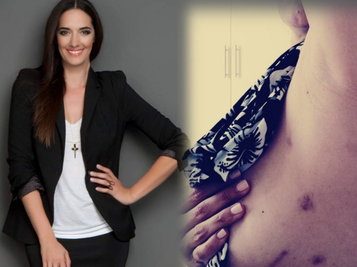 Νόνη Δούνια: Δείχνει τα σημάδια από το σοβαρό χειρουργείο που έκανε και συγκινεί – “Εκείνο το πρωί που ξύπνησα…”