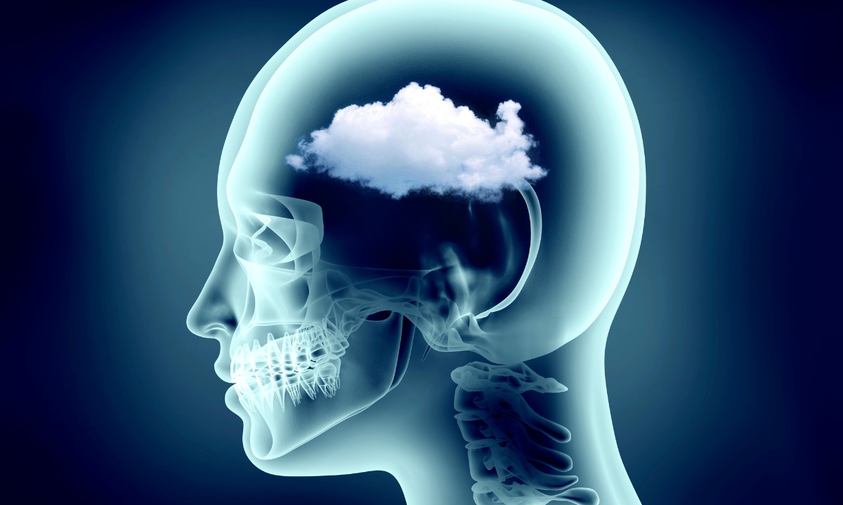 COVID-19: Τι ξέρουμε για την ομίχλη εγκεφάλου που προκαλεί ο κορονοϊός