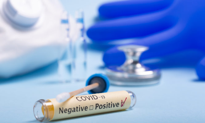 Κορονοϊός: Νέο τεστ ανιχνεύει με 8 φορές μεγαλύτερη ακρίβεια τις παλιές λοιμώξεις