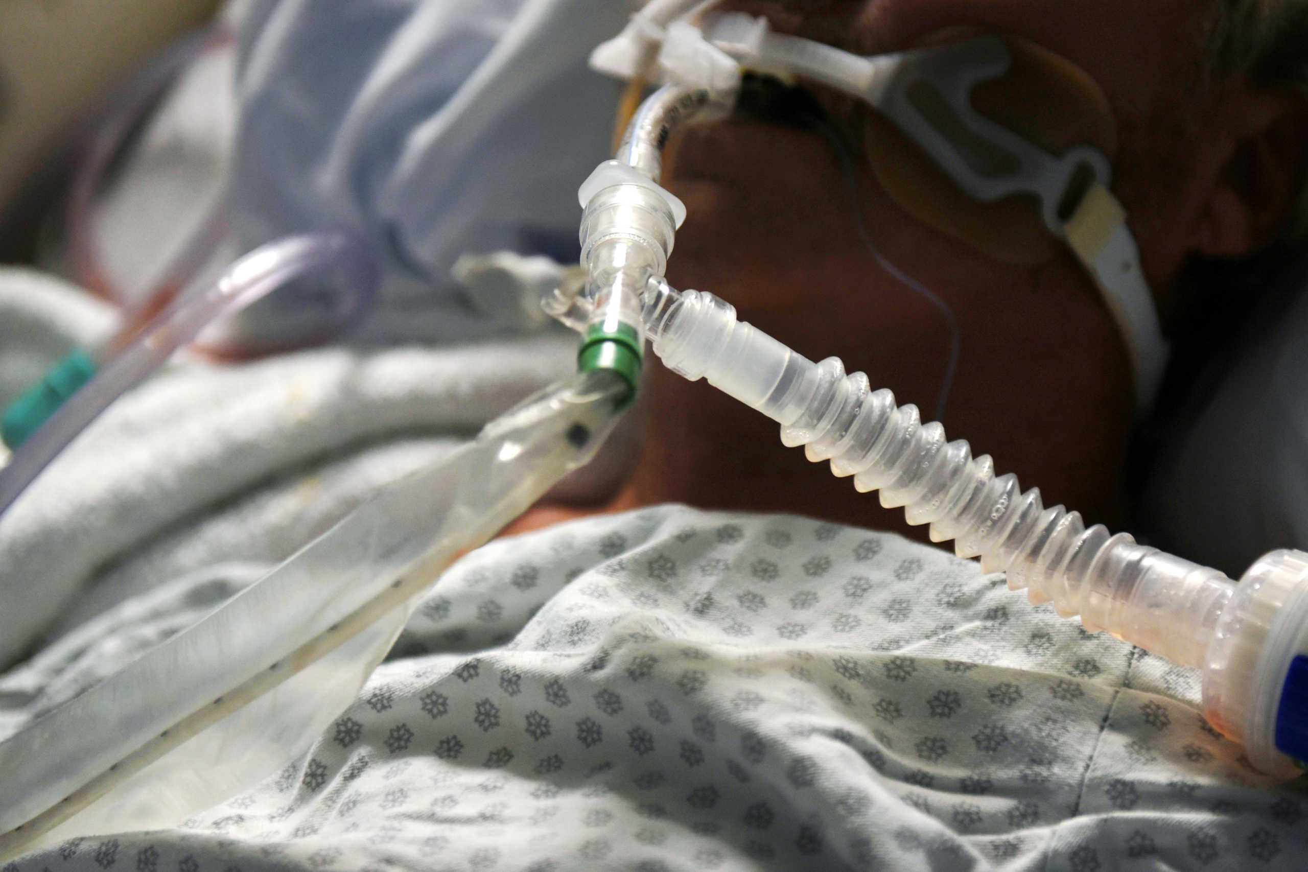 FILE PHOTO: A patient on a ventilator is seen as medical professionals treat patients infected with the coronavirus disease (COVID-19) at United Memorial Medical Center in Houston, Texas, U.S., November 12, 2020.  REUTERS