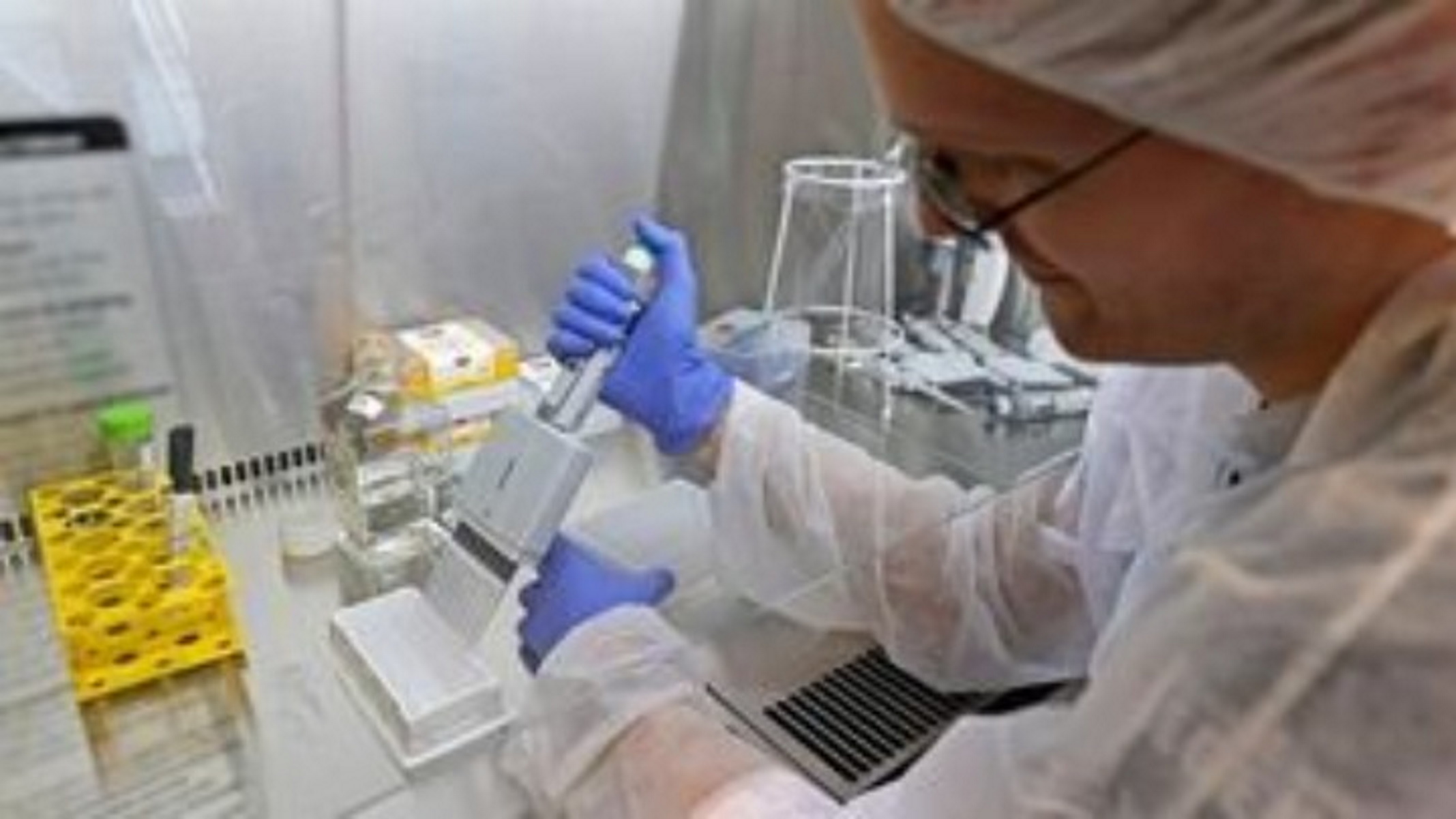 Κορονοϊός: Η κολχικίνη δεν καταπολεμά τον φονικό ιό, προειδοποιεί διεθνής έρευνα