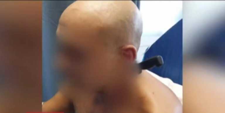 Καλαμάτα: Στο νοσοκομείο με το μαχαίρι  που του κάρφωσε στο λαιμό η κουμπάρα του – Εξελίξεις στην υπόθεση (video)