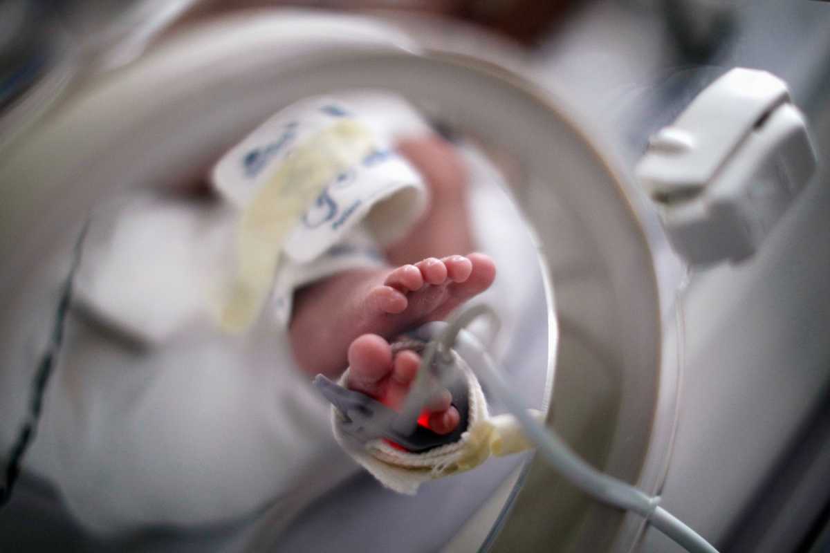 Βραζιλία: Μωρό γεννήθηκε με «ανθρώπινη ουρά» 12 εκατοστών