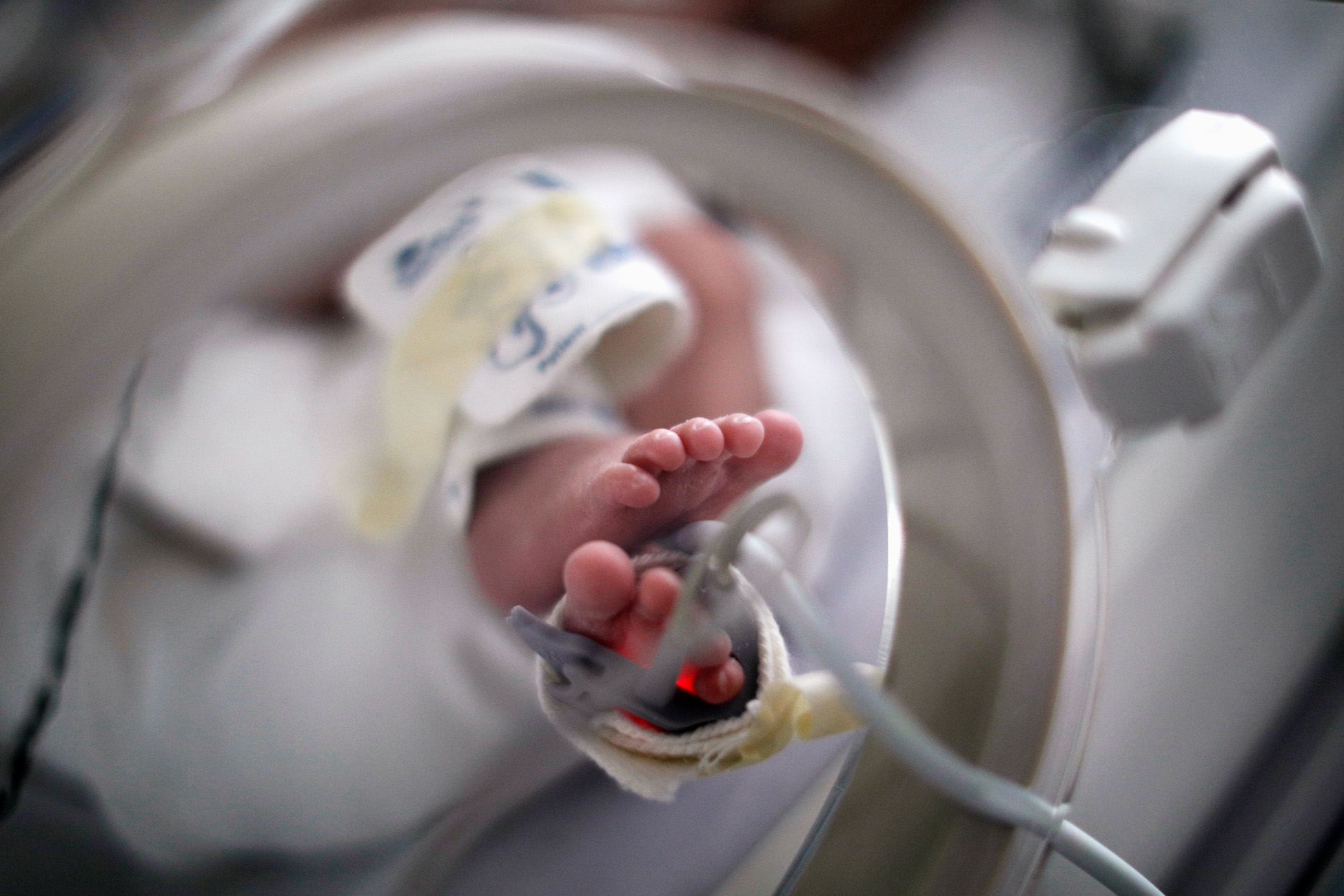 Νεογέννητο πνίγηκε με το γάλα του και πέθανε μέσα στο νοσοκομείο